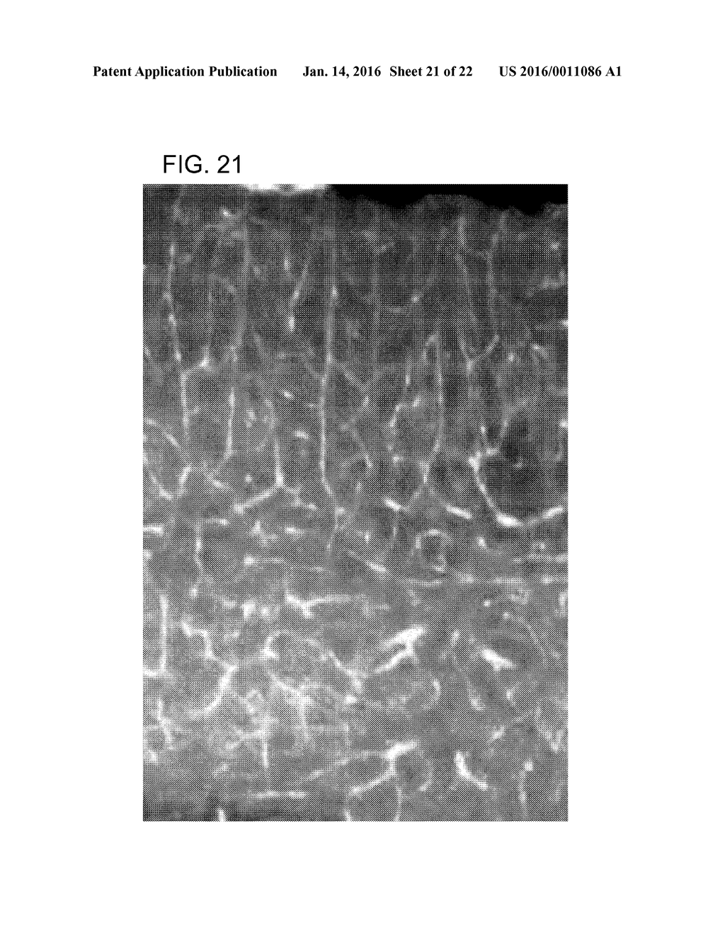 METHOD FOR RENDERING TISSUE TRANSPARENT, REAGENT FOR RENDERING TISSUE     TRANSPARENT, AND TISSUE OBSERVATION METHOD - diagram, schematic, and image 22