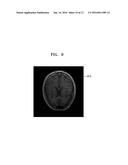 MAGNETIC RESONANCE IMAGING APPARATUS AND METHOD diagram and image