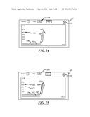 Vibration Treatment Method and Graphical User Interface diagram and image