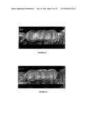 IMAGE ANALYSIS FOR MAKING ANIMAL MEASUREMENTS INCLUDING 3-D IMAGE ANALYSIS diagram and image