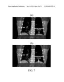 METHODS, SYSTEMS, AND COMPUTER READABLE MEDIA FOR REAL-TIME 2D/3D     DEFORMABLE REGISTRATION USING METRIC LEARNING diagram and image