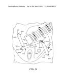 Tremolo Bar And Associated Assembly And Tremolo Arm Accessory diagram and image