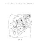 Tremolo Bar And Associated Assembly And Tremolo Arm Accessory diagram and image