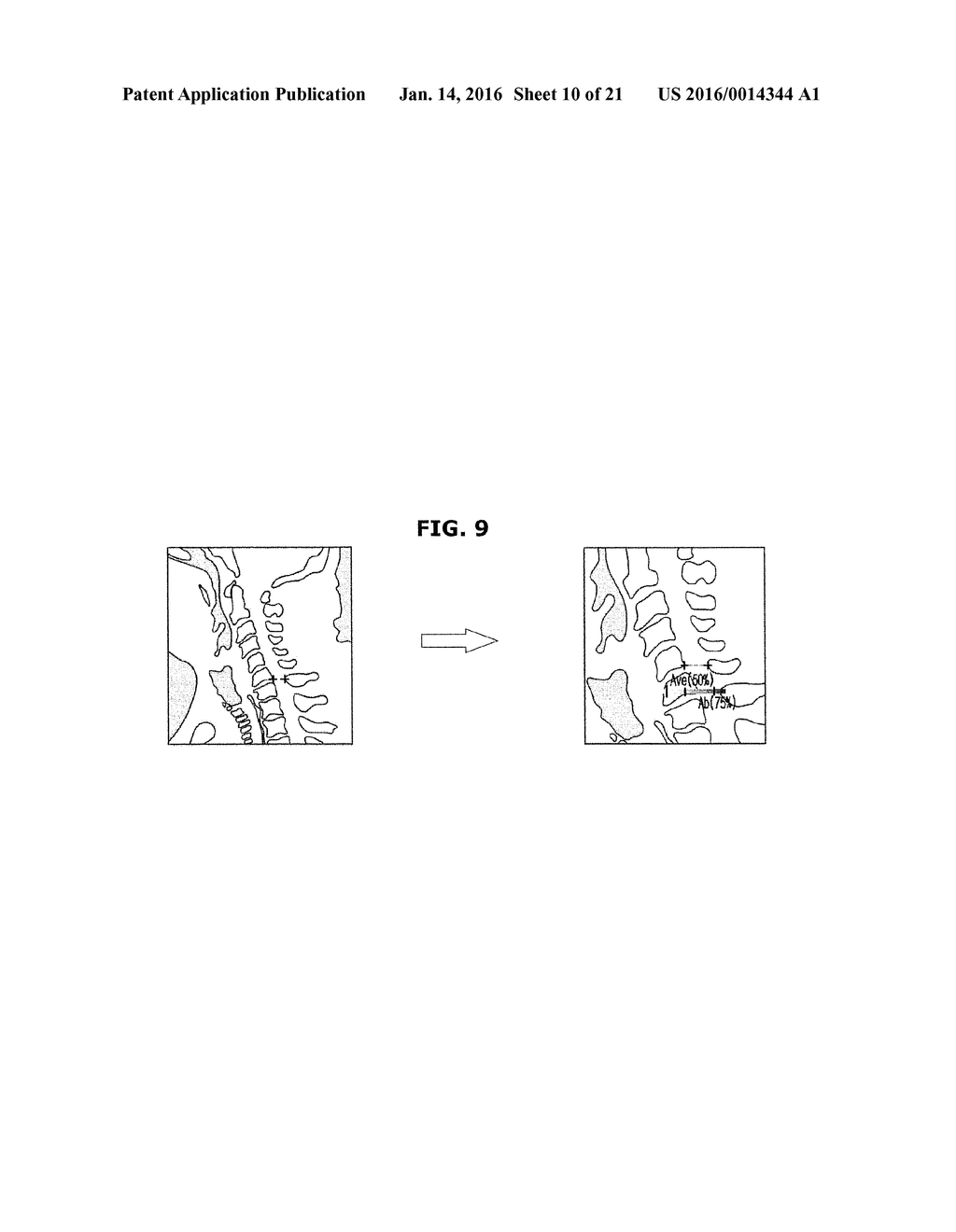 IMAGING APPARATUS AND CONTROL METHOD THEREOF - diagram, schematic, and image 11