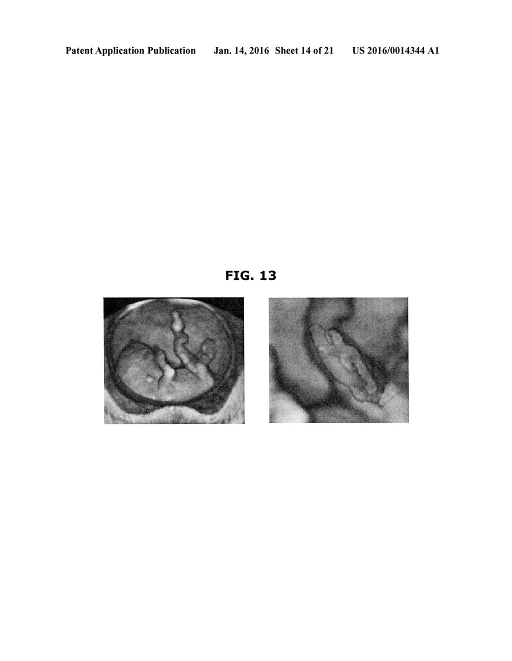 IMAGING APPARATUS AND CONTROL METHOD THEREOF - diagram, schematic, and image 15