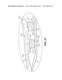 ARTICLE OF FOOTWEAR HAVING AN ELEVATED PLATE SOLE STRUCTURE diagram and image