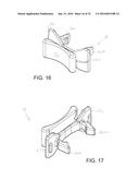 Anti-Theft Ring Assembly and Method of Using the Same diagram and image