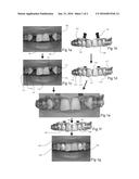 VISUALISING A 3D DENTAL RESTORATION ON A 2D IMAGE diagram and image