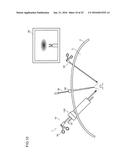 ENDOSCOPIC SURGERY DEVICE diagram and image