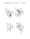 Medical Devices and Methods diagram and image