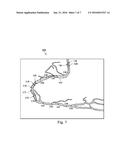 DEVICES, SYSTEMS, AND METHODS AND ASSOCIATED DISPLAY SCREENS FOR     ASSESSMENT OF VESSELS WITH MULTIPLE SENSING COMPONENTS diagram and image