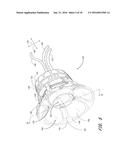 DISPOSABLE PATIENT INTERFACE FOR INTRADUCTAL FLUID ASPIRATION SYSTEM diagram and image