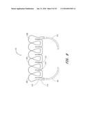 DISPOSABLE PATIENT INTERFACE FOR INTRADUCTAL FLUID ASPIRATION SYSTEM diagram and image