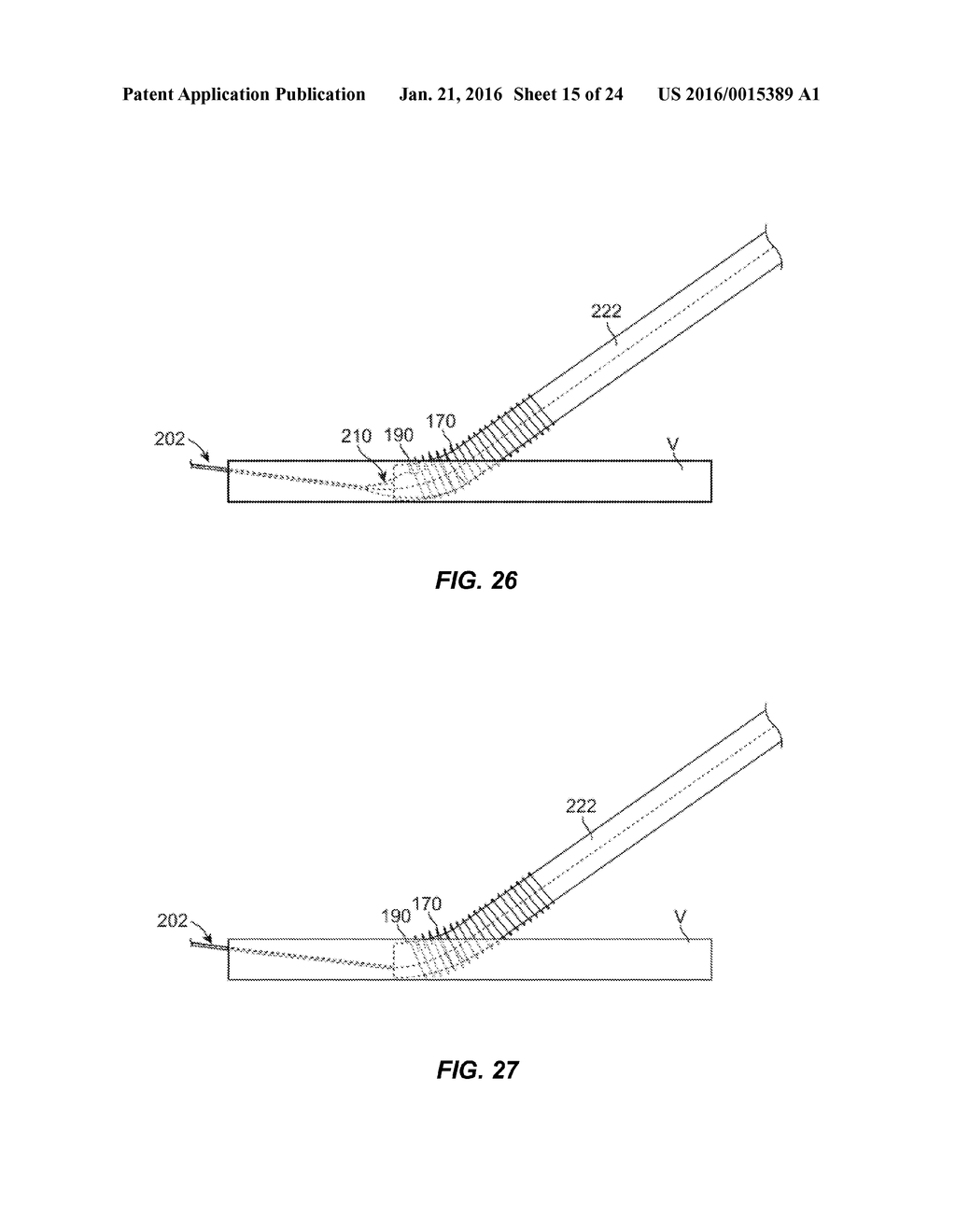 METHODS AND SYSTEMS FOR ADVANCING AND ANCHORING SUTURE IN TISSUE - diagram, schematic, and image 16