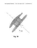 Occluder For Occluding An Atrial Appendage And Production Process Therefor diagram and image