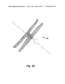 Occluder For Occluding An Atrial Appendage And Production Process Therefor diagram and image