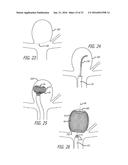 FILAMENTARY DEVICES FOR TREATMENT OF VASCULAR DEFECTS diagram and image