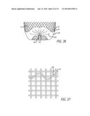 FILAMENTARY DEVICES FOR TREATMENT OF VASCULAR DEFECTS diagram and image