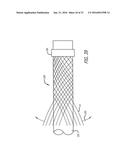 FILAMENTARY DEVICES FOR TREATMENT OF VASCULAR DEFECTS diagram and image