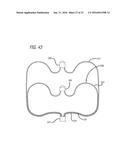 FILAMENTARY DEVICES FOR TREATMENT OF VASCULAR DEFECTS diagram and image