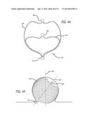 FILAMENTARY DEVICES FOR TREATMENT OF VASCULAR DEFECTS diagram and image