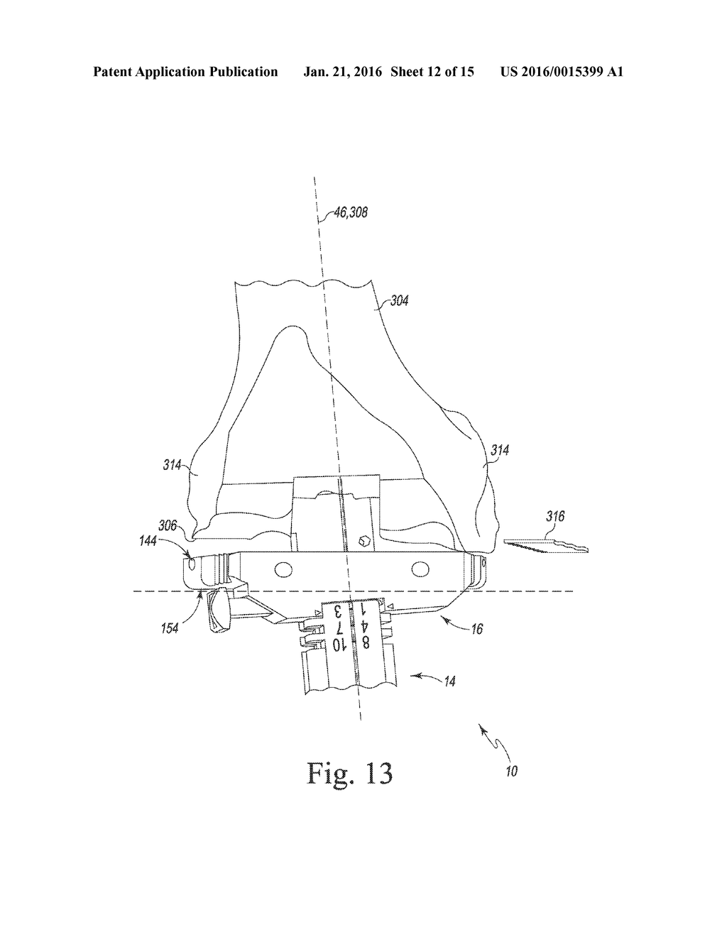 METHOD OF USING A FEMORAL SURGICAL INSTRUMENT - diagram, schematic, and image 13