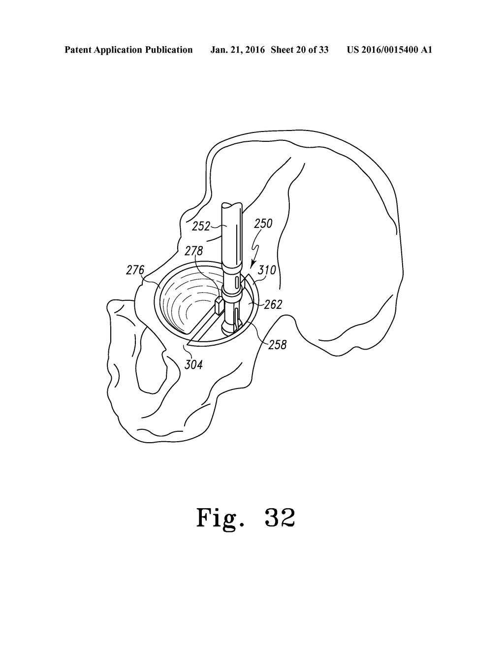 RECIPROCATING RASPS FOR USE IN AN ORTHOPAEDIC SURGICAL PROCEDURE - diagram, schematic, and image 21