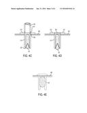 Method and Apparatus for Tissue Copying and Grafting diagram and image