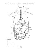 DEVICES AND METHODS FOR INTRAHEPATIC SHUNTS diagram and image