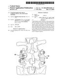 INVERTED SERPENTINE SPINAL STABILITY DEVICE AND ASSOCIATED METHODS diagram and image