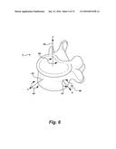 INVERTED SERPENTINE SPINAL STABILITY DEVICE AND ASSOCIATED METHODS diagram and image