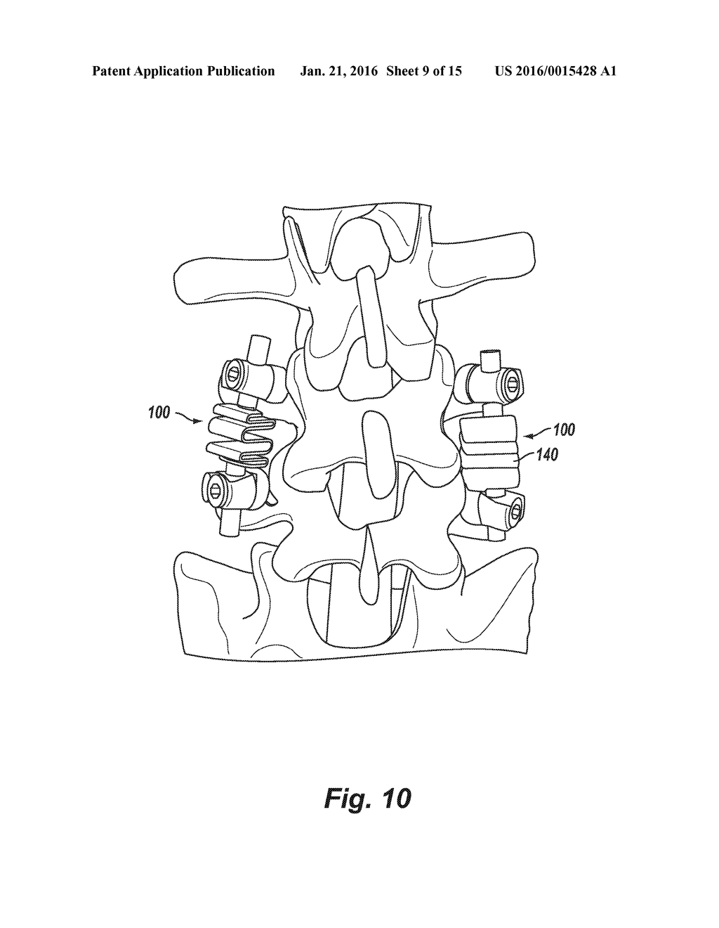 INVERTED SERPENTINE SPINAL STABILITY DEVICE AND ASSOCIATED METHODS - diagram, schematic, and image 10