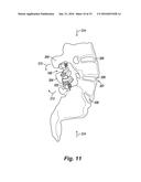 INVERTED SERPENTINE SPINAL STABILITY DEVICE AND ASSOCIATED METHODS diagram and image