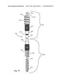 BONE COMPRESSION SCREW diagram and image