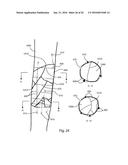 BONE COMPRESSION SCREW diagram and image