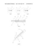 Steerable Cannula for Delivering Bone Filler diagram and image