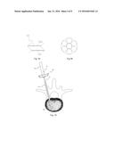 Steerable Cannula for Delivering Bone Filler diagram and image