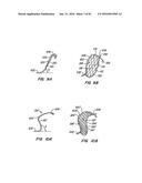 ENDOLUMINAL FILTER HAVING ENHANCED ECHOGENIC PROPERTIES diagram and image