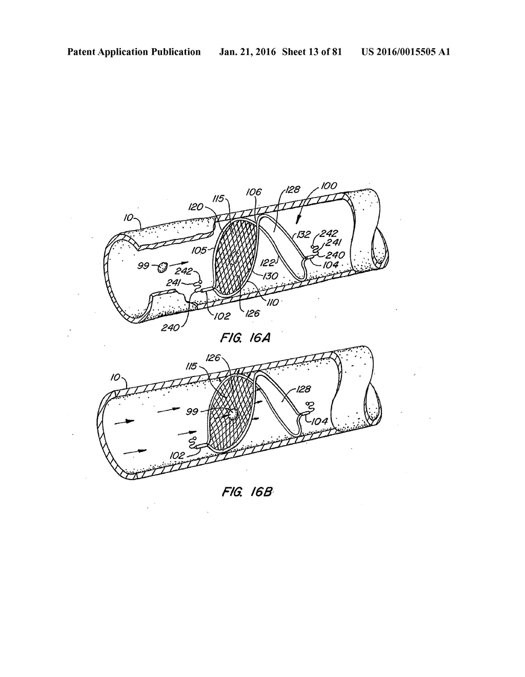 ENDOLUMINAL FILTER HAVING ENHANCED ECHOGENIC PROPERTIES - diagram, schematic, and image 14