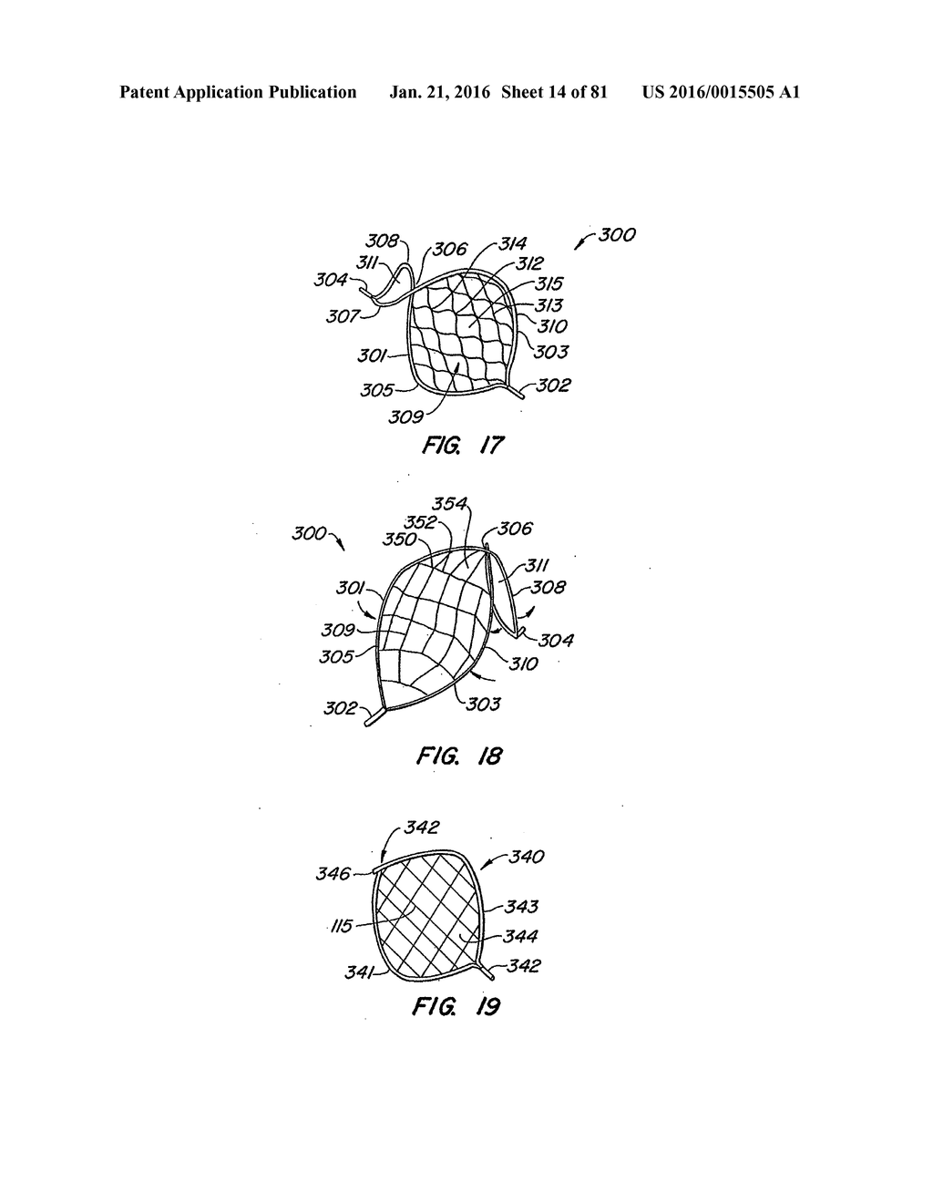 ENDOLUMINAL FILTER HAVING ENHANCED ECHOGENIC PROPERTIES - diagram, schematic, and image 15