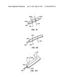 ENDOLUMINAL FILTER HAVING ENHANCED ECHOGENIC PROPERTIES diagram and image