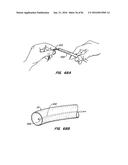 ENDOLUMINAL FILTER HAVING ENHANCED ECHOGENIC PROPERTIES diagram and image