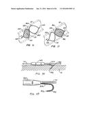 ENDOLUMINAL FILTER HAVING ENHANCED ECHOGENIC PROPERTIES diagram and image