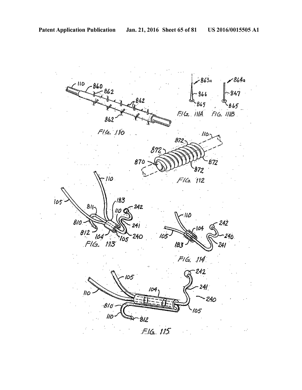 ENDOLUMINAL FILTER HAVING ENHANCED ECHOGENIC PROPERTIES - diagram, schematic, and image 66