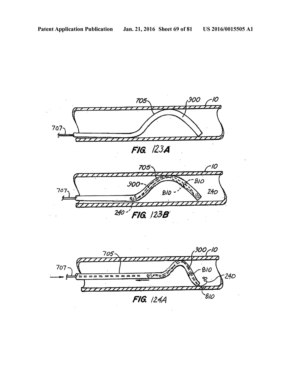 ENDOLUMINAL FILTER HAVING ENHANCED ECHOGENIC PROPERTIES - diagram, schematic, and image 70