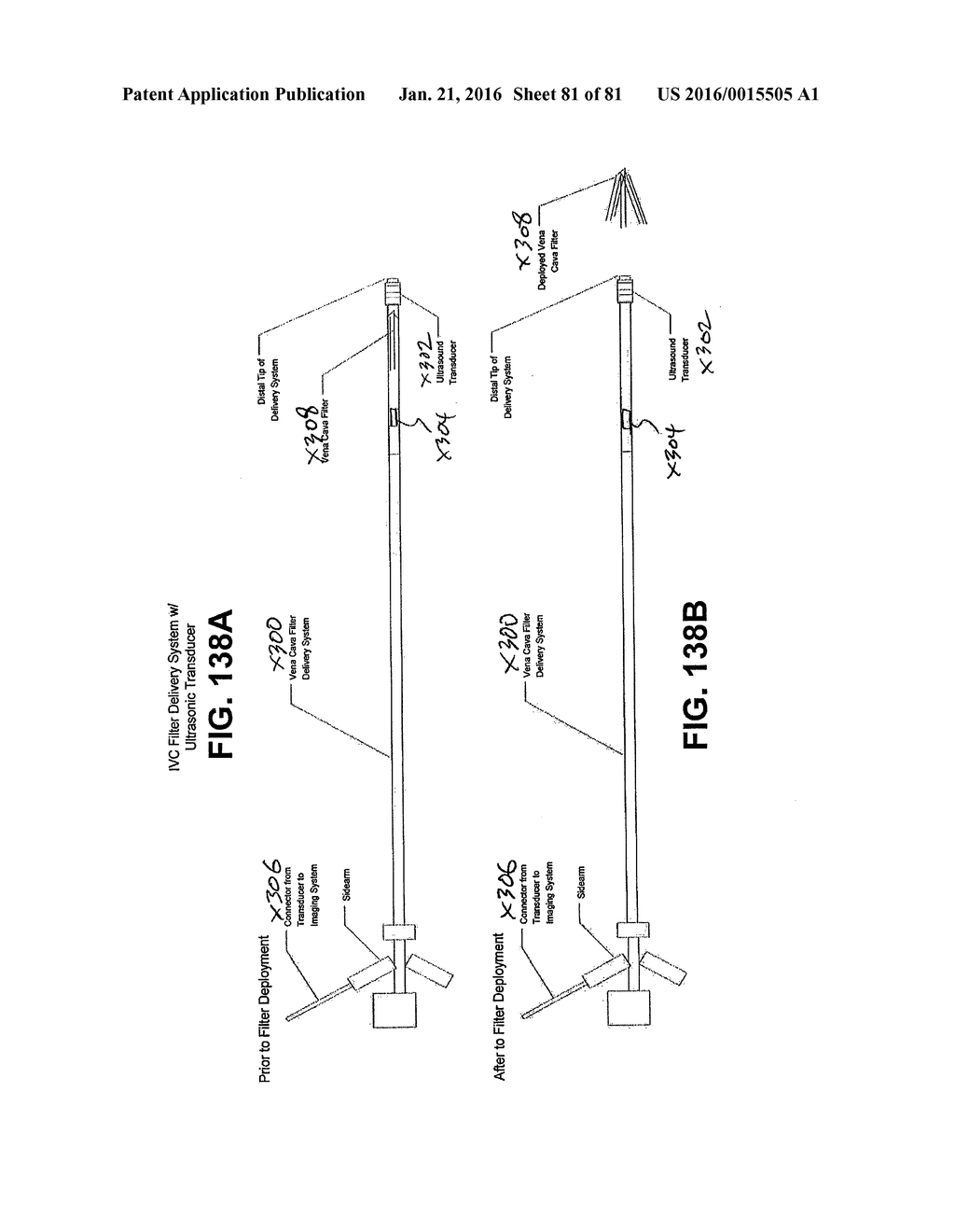 ENDOLUMINAL FILTER HAVING ENHANCED ECHOGENIC PROPERTIES - diagram, schematic, and image 82