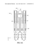 ADJUSTABLE ENDOLUMENAL IMPLANT FOR RESHAPING THE MITRAL VALVE ANNULUS diagram and image