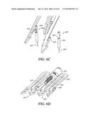 ADJUSTABLE ENDOLUMENAL IMPLANT FOR RESHAPING THE MITRAL VALVE ANNULUS diagram and image