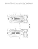 ADJUSTABLE ENDOLUMENAL IMPLANT FOR RESHAPING THE MITRAL VALVE ANNULUS diagram and image