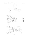 ADJUSTABLE ENDOLUMENAL IMPLANT FOR RESHAPING THE MITRAL VALVE ANNULUS diagram and image